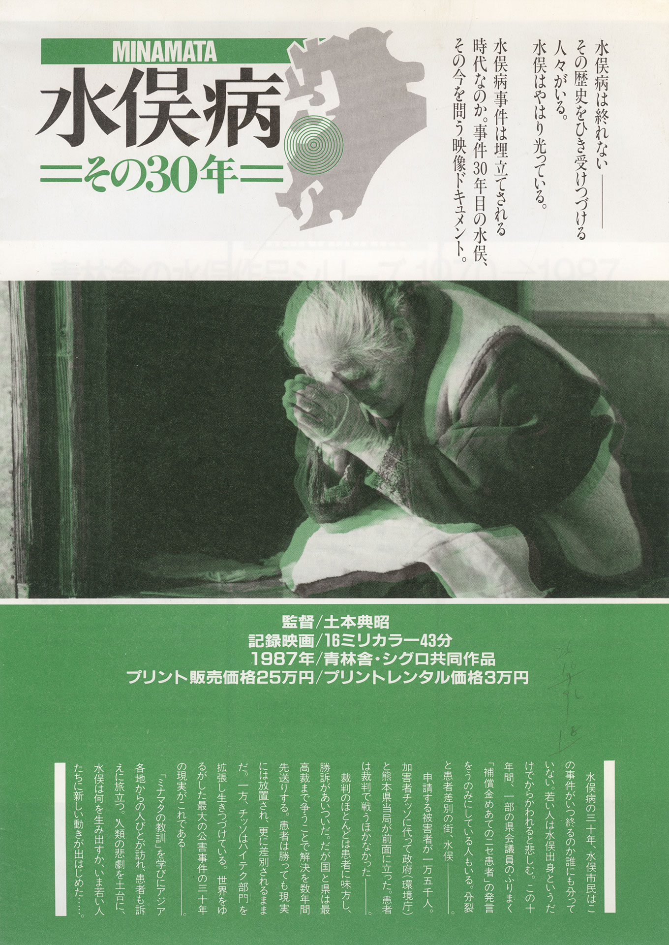 水俣病 その30年