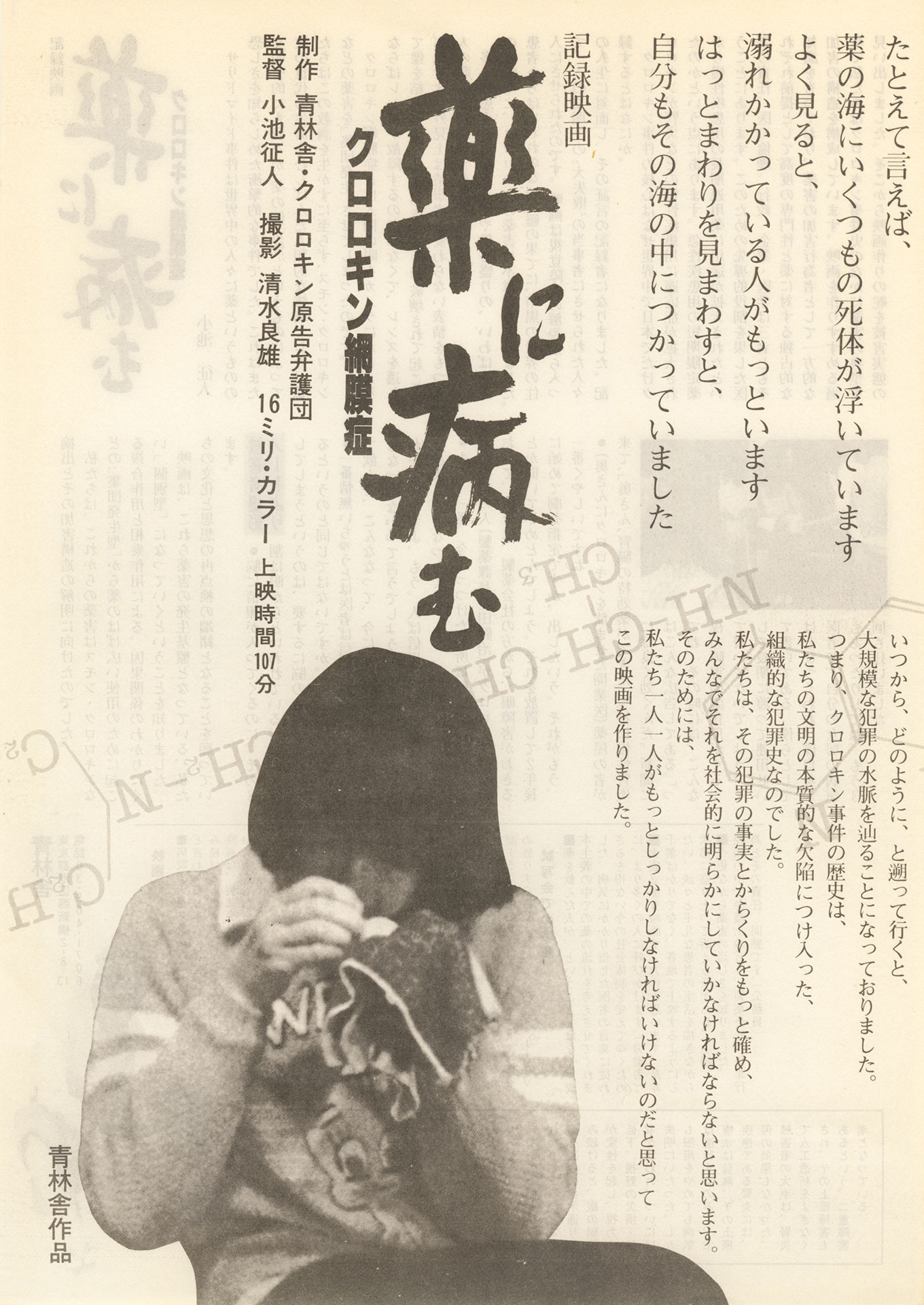薬に病む クロロキン網膜症